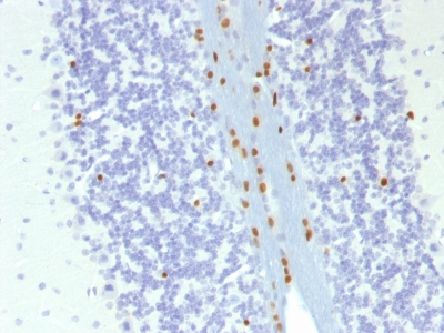 Formalin-fixed, paraffin embedded mouse sections stained with 100 ul anti-SOX10 (clone SOX10/1074) at 1:300. HIER epitope retrieval prior to staining was performed in 10mM Citrate, pH 6.0.